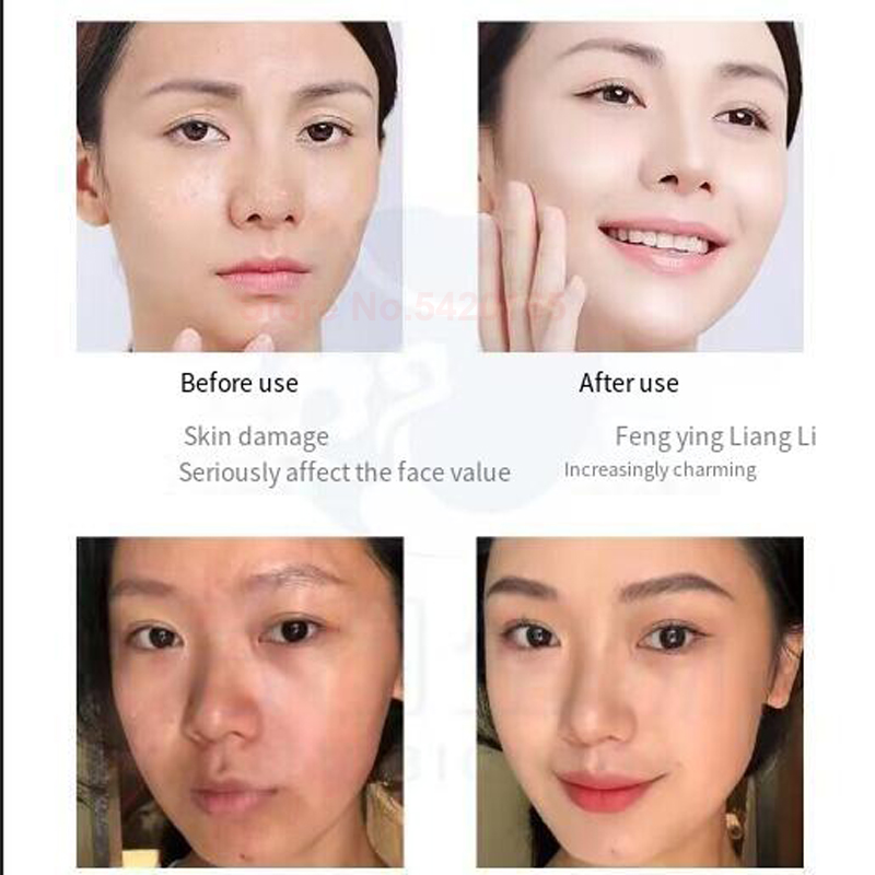 0.25 mm Microneedle GHK-Cu Blu - огляд і ціна Epidermal Growth Factor